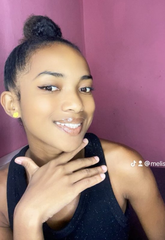 Melisca • 21 • Madagascar