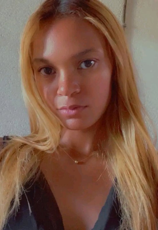 Kanto • 26 • Madagascar